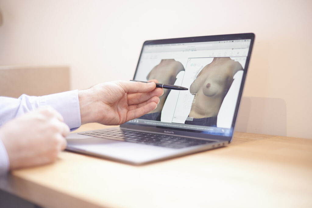 3D simulatie plastische chirurgie